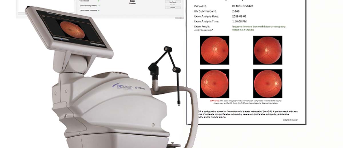 FDA permits marketing of LumineticsCore™ (formerly known as IDx-DR) for automated detection of diabetic retinopathy in primary care