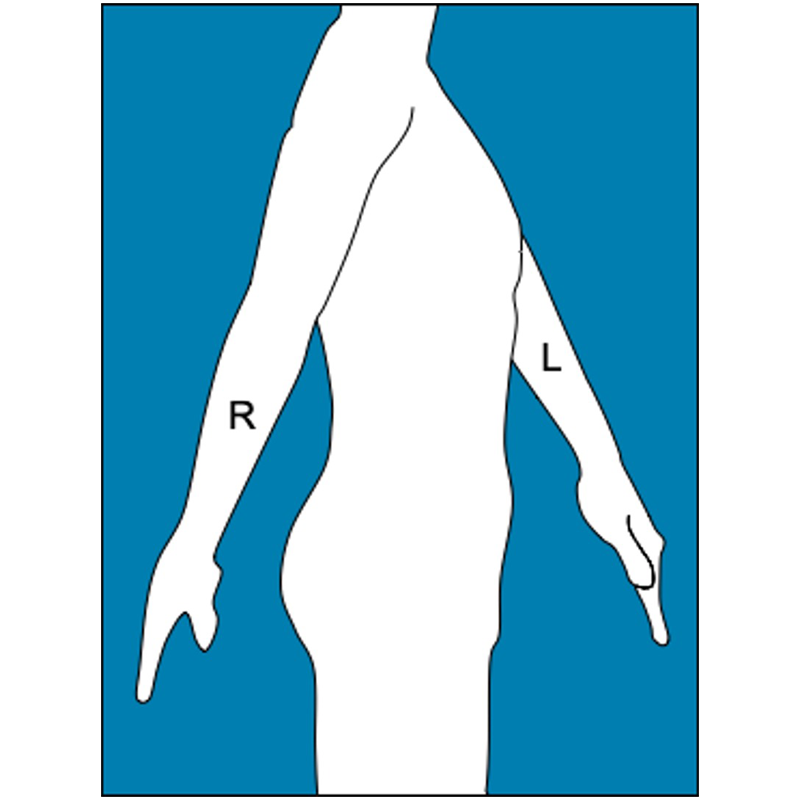 Pose Selector guides patients through specific clinical poses.