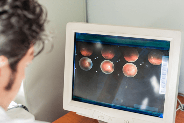4 Benefits of Ophthalmic Imaging Technology for Diabetic Retinopathy